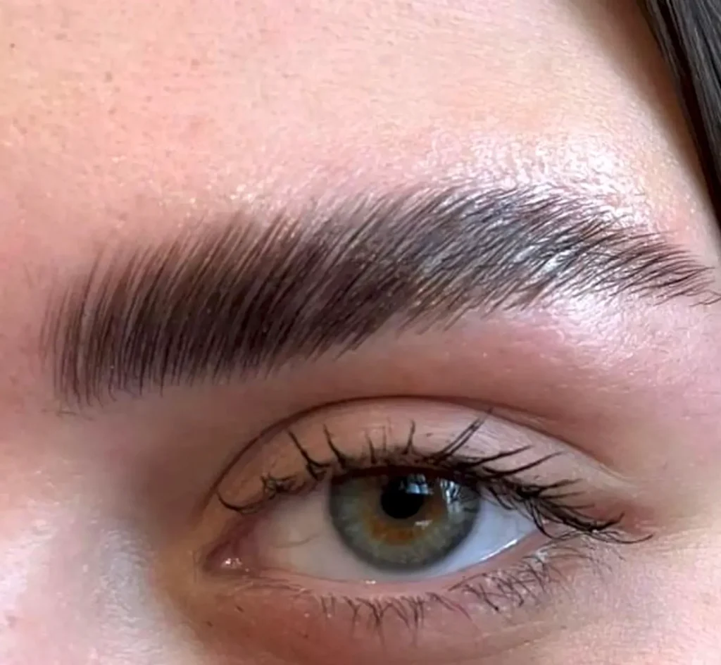cosmetic procedure